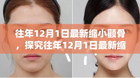 探究最新缩小颧骨术，利弊分析与个人观点