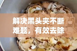 解决黑头夹不断难题，有效去除黑头指南