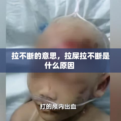 拉不断的意思，拉屎拉不断是什么原因 