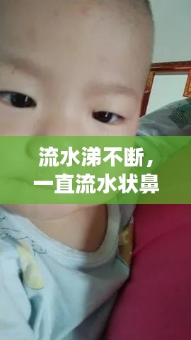 流水涕不断，一直流水状鼻涕 