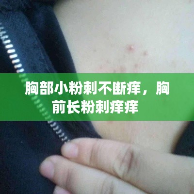 胸部小粉刺不断痒，胸前长粉刺痒痒 