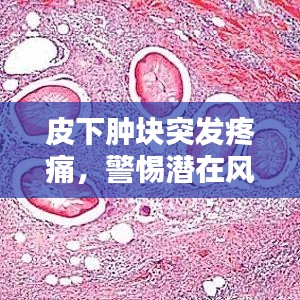 皮下肿块突发疼痛，警惕潜在风险，深入了解症状原因
