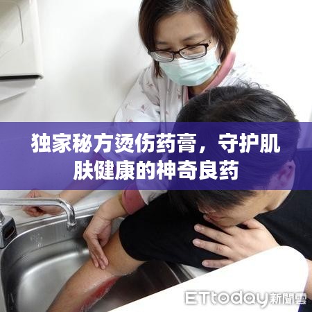 独家秘方烫伤药膏，守护肌肤健康的神奇良药