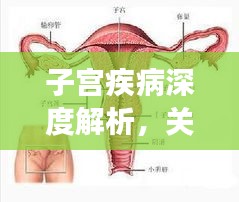 子宫疾病深度解析，关爱女性健康专题