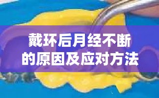 戴环后月经不断的原因及应对方法解析