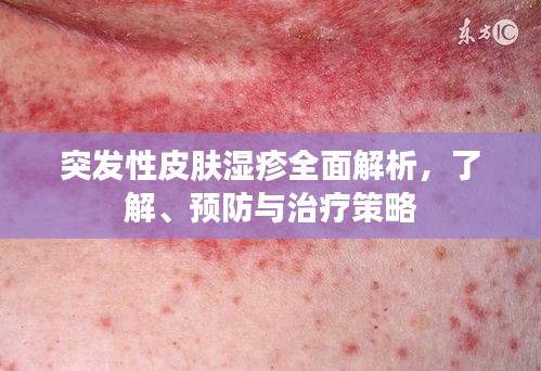 突发性皮肤湿疹全面解析，了解、预防与治疗策略