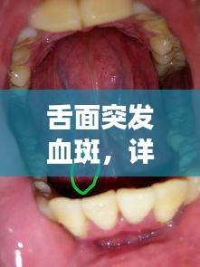 舌面突发血斑，详解症状、诱因与应对方法