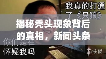 揭秘秃头现象背后的真相，新闻头条独家报道