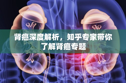 肾癌深度解析，知乎专家带你了解肾癌专题