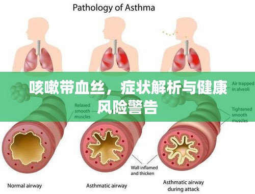 咳嗽带血丝，症状解析与健康风险警告
