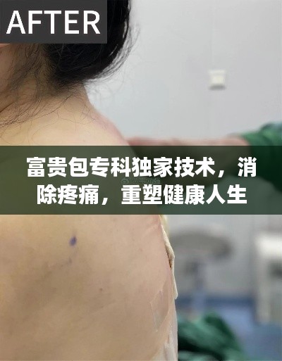 富贵包专科独家技术，消除疼痛，重塑健康人生